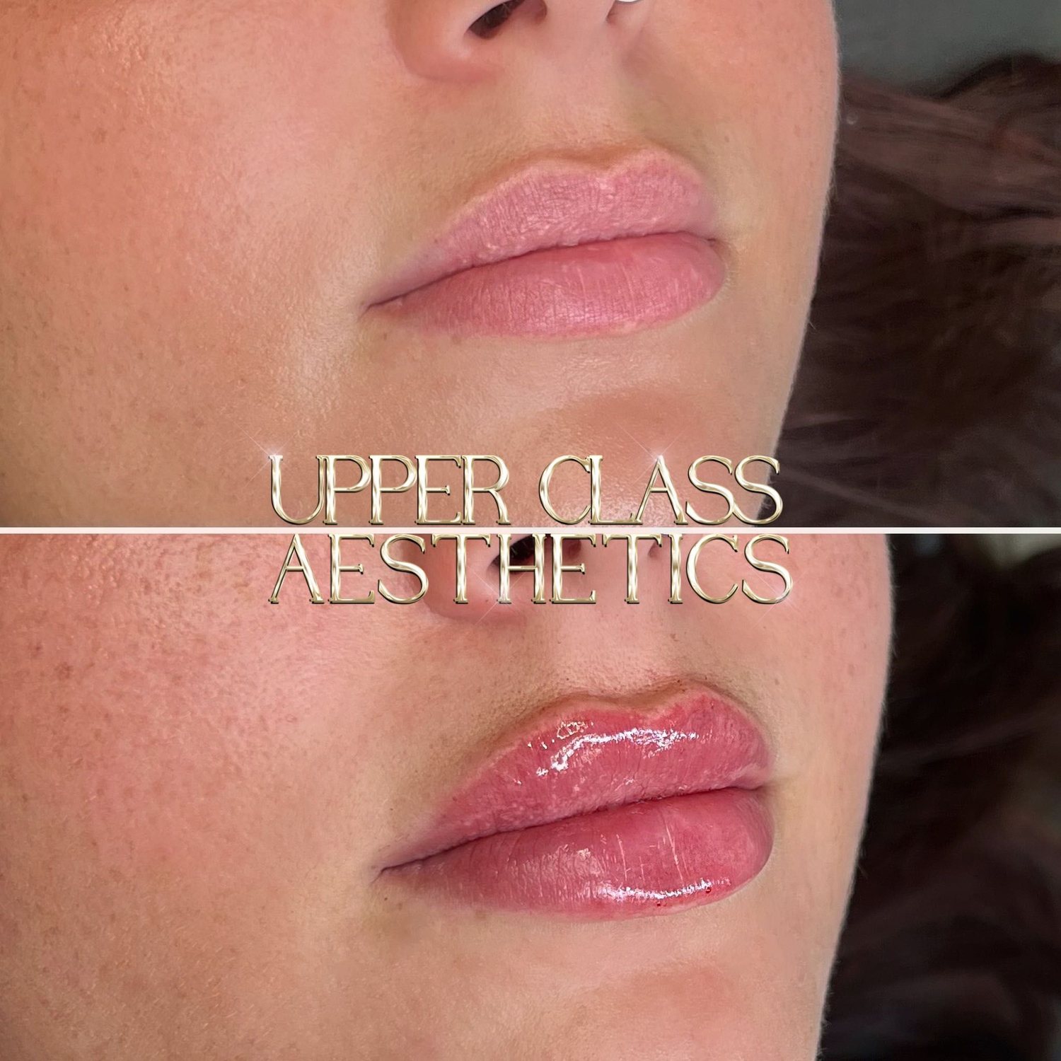 A client’s lips before and after treatment, example 1
