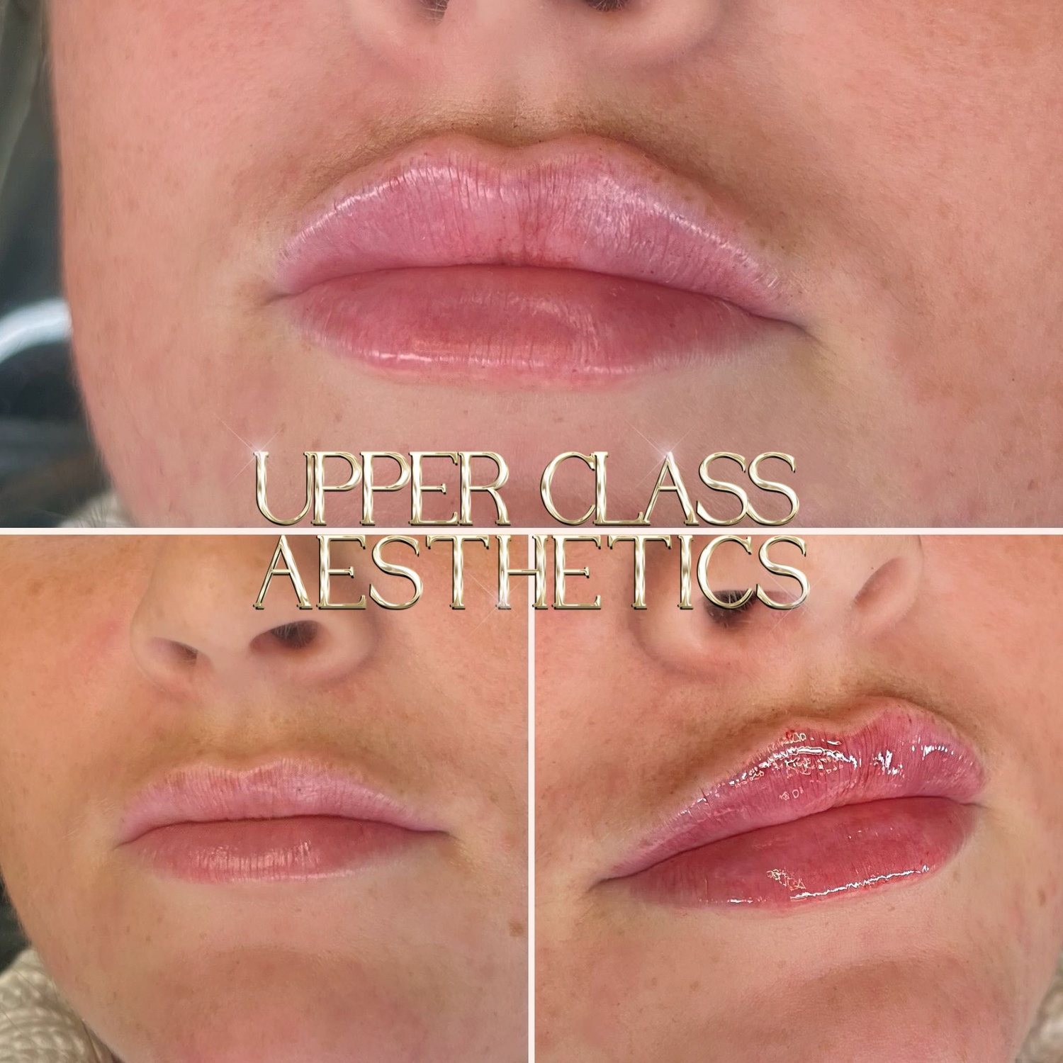 A client’s lips before and after treatment, example 7