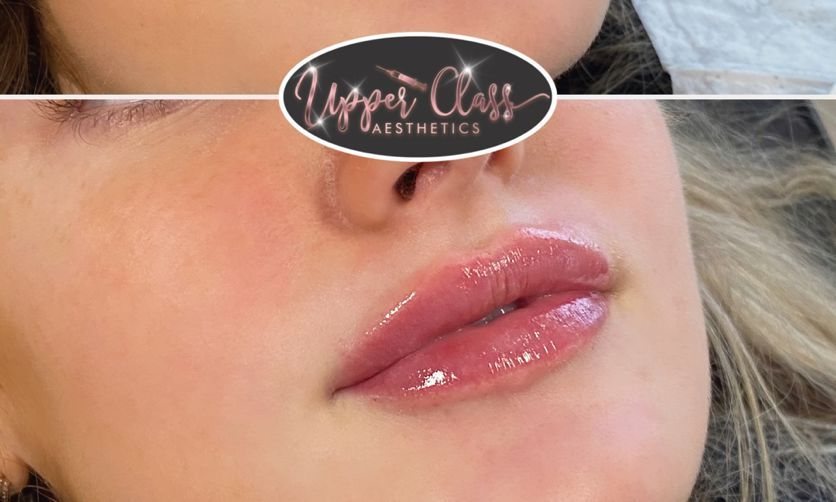 A client’s lips after treatment, example 3