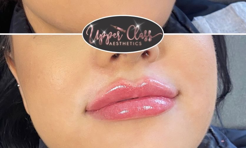 A client’s lips after treatment, example 4